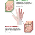 Crema hidratanta profesionala pentru ingrijirea mainilor Gojo Hand Medic ingrijeste, hidrateaza si catifeleaza si previne uscarea si craparea pielii_3